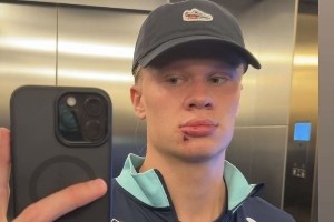 开云官网-【小吧社交秀】哈兰德帅脸惨遭“破相”  内维斯女友青春甜美